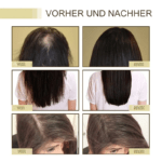 Natürliches Haarwuchsöl