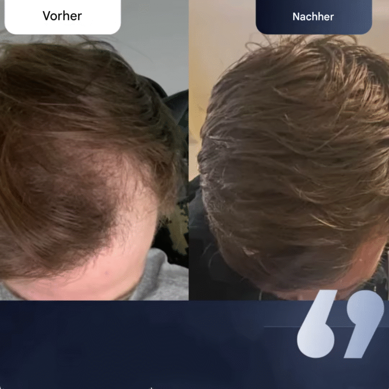 Serum für Haarwachstum