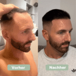 Serum für Haarwachstum