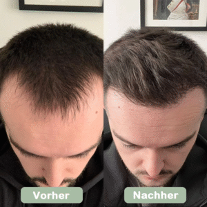 Haarpflege Produkt online Schweiz